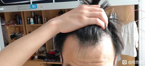 ”戒色恢复头发