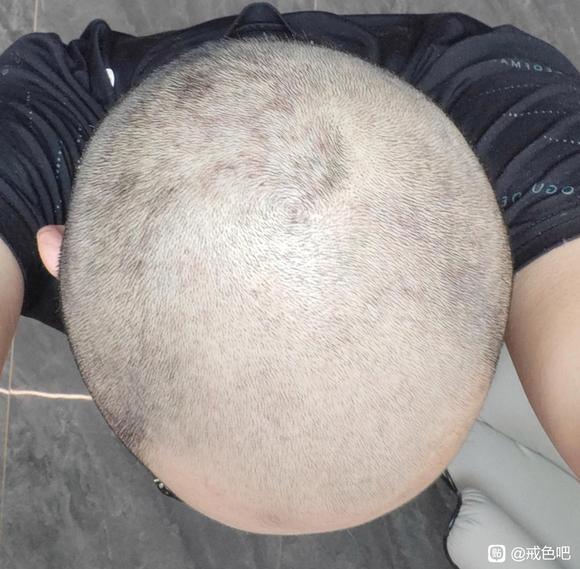 ”持续发