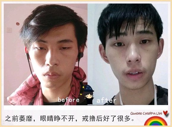 ”戒色恢复对比图,猥琐男变帅气