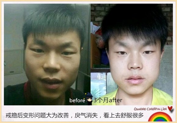 ”戒色恢复对比图,猥琐男变帅气