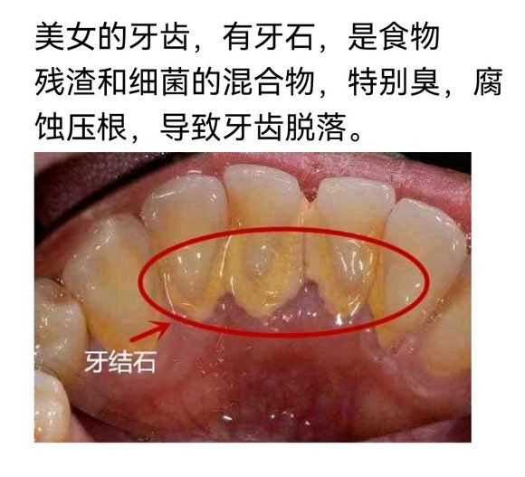 ”怎么戒，什么方法戒