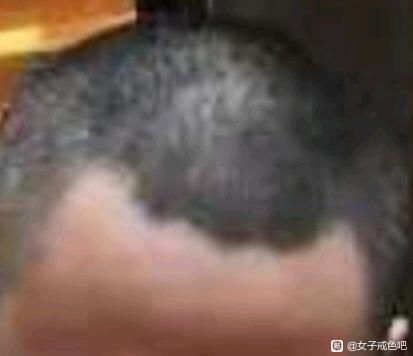 ”戒断+养生，你的头发会变厚！