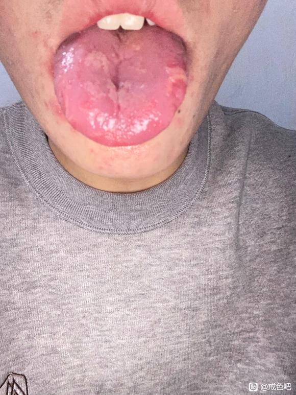 ”戒色之后怎么恢复啊