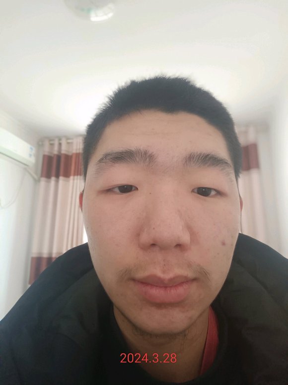 ”【发帖先看置顶】求助，鼻子怎么才能快点恢复啊？戒色九天了，皮