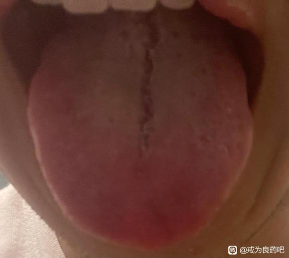 ”急需帮助,刚从戒色吧转来