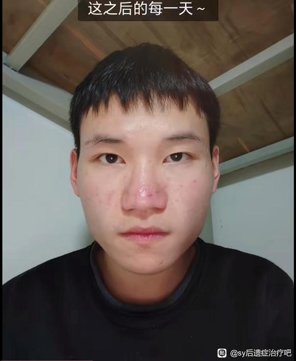”戒色45天恢复很多
