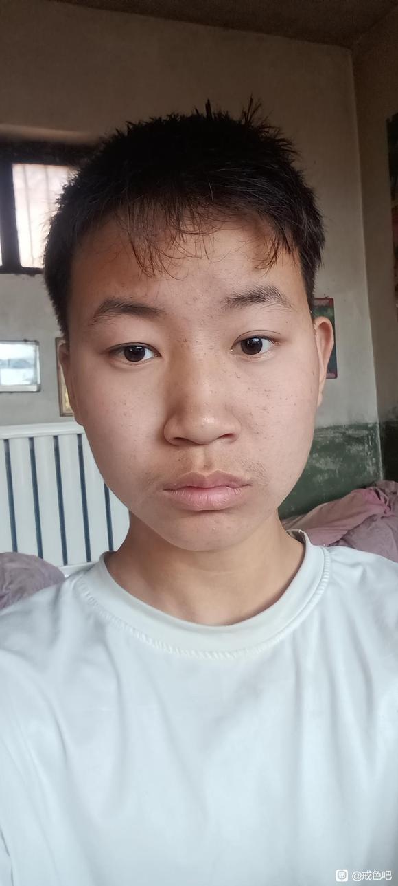 ”脸部变形眼睛一大一小还有救吗
