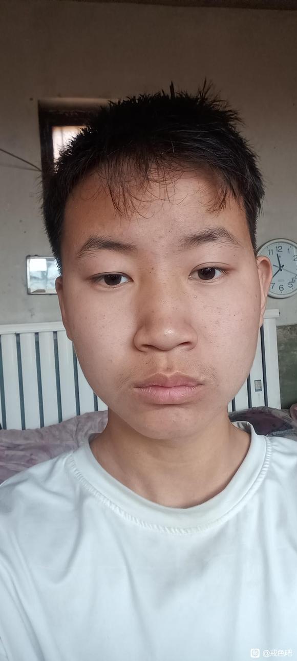 ”脸部变形眼睛一大一小还有救吗