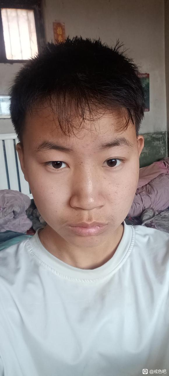 ”脸部变形眼睛一大一小还有救吗