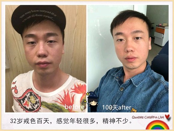 ”戒色恢复对比图,丑小鸭变天鹅!