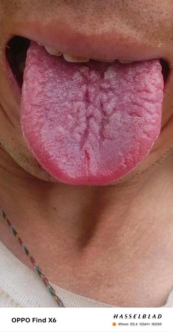 ”#微信看病卖药是假的#戒色