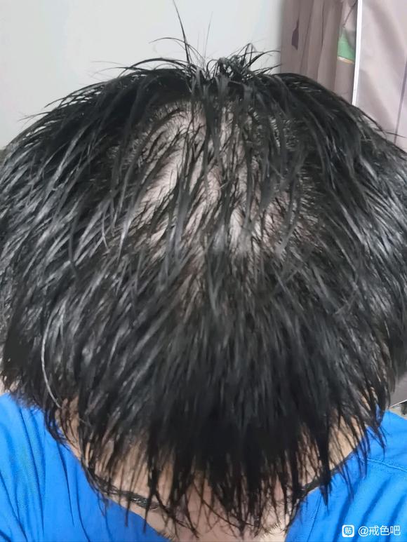 ”这还能恢复吗？目前戒色一个月