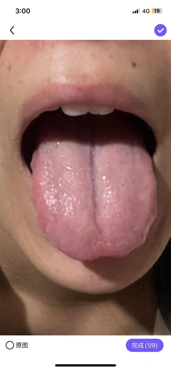 ”有脾虚恢复的吗，可以说下经验吗