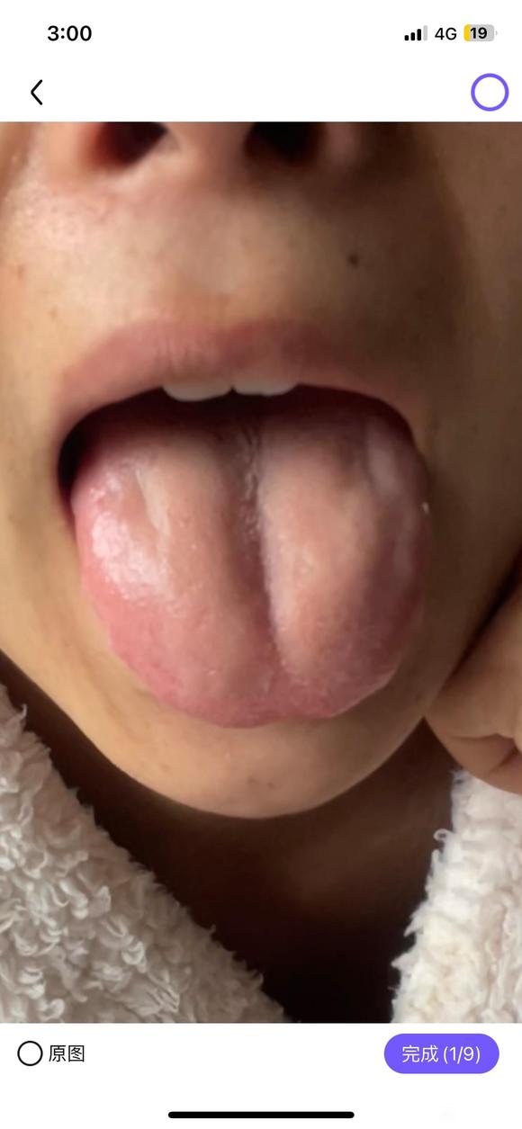 ”有脾虚恢复的吗，可以说下经验吗