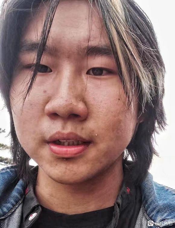 ”戒的第336天想分享给大家一点经验，再上一组颜值对比刚拍的