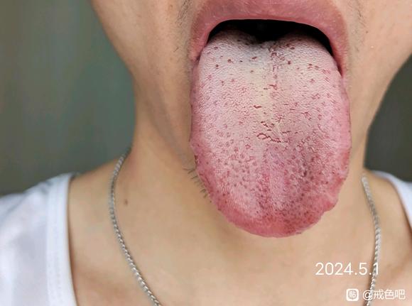 ”喝了两年中药，还是失败