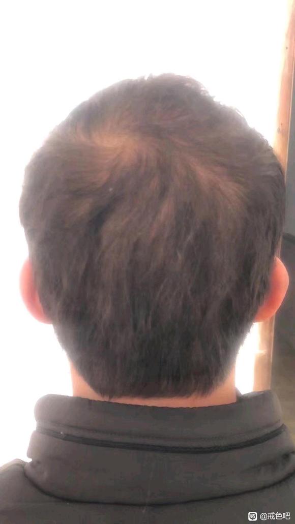 ”戒色五百多天时，头发恢复了