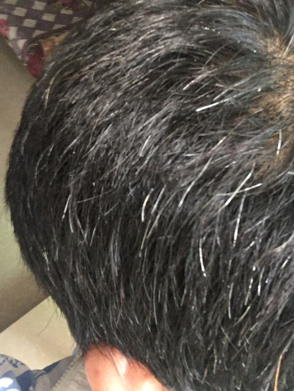 ”这么多白头发，怎么办？帮帮忙啊