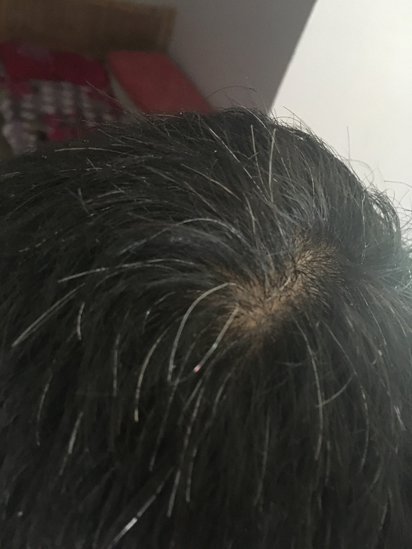 ”这么多白头发，怎么办？帮帮忙啊