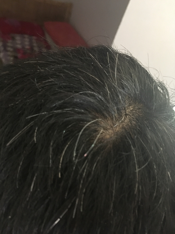 ”这么多白头发，怎么办？帮帮忙啊