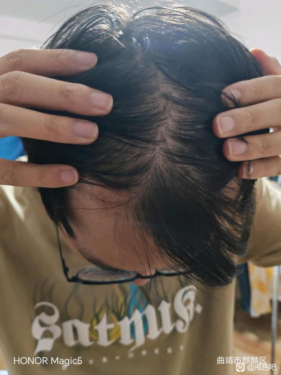 ”越戒越掉，头油的不行