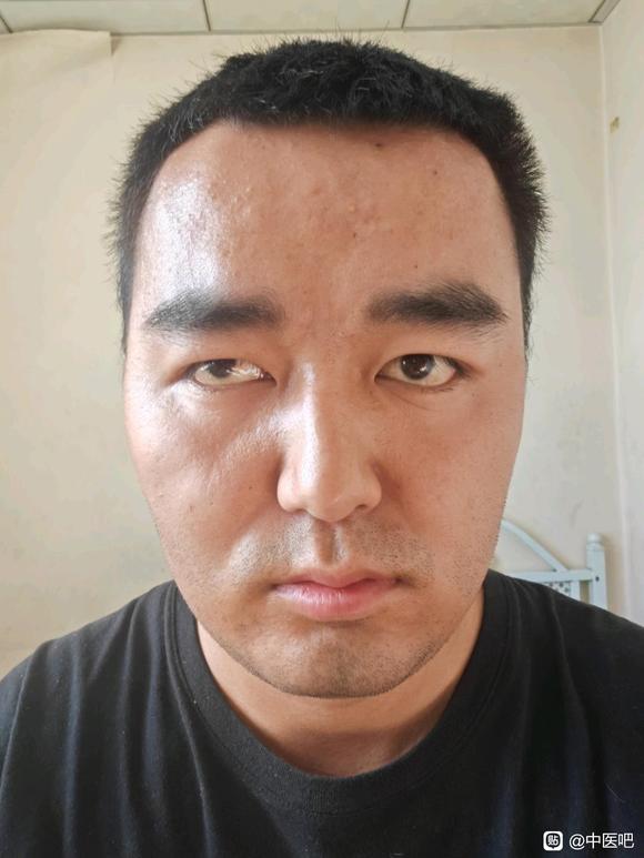 ”【发帖先看置顶】本人因手淫症状缠身希望能得高人指点