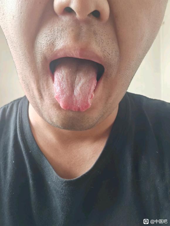 ”【发帖先看置顶】本人因手淫症状缠身希望能得高人指点