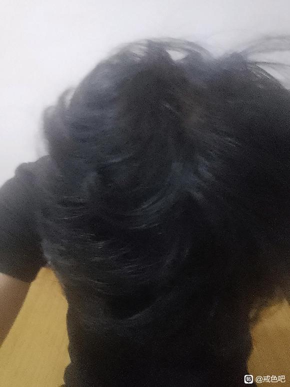 ”吧看见好多20来岁人头发秃了，我这个没有问题吧