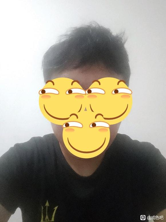 ”吧看见好多20来岁人头发秃了，我这个没有问题吧