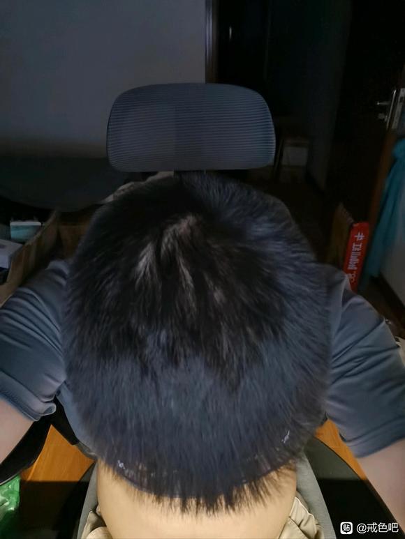 ”戒色有一段时间，最近头发掉的有点厉害