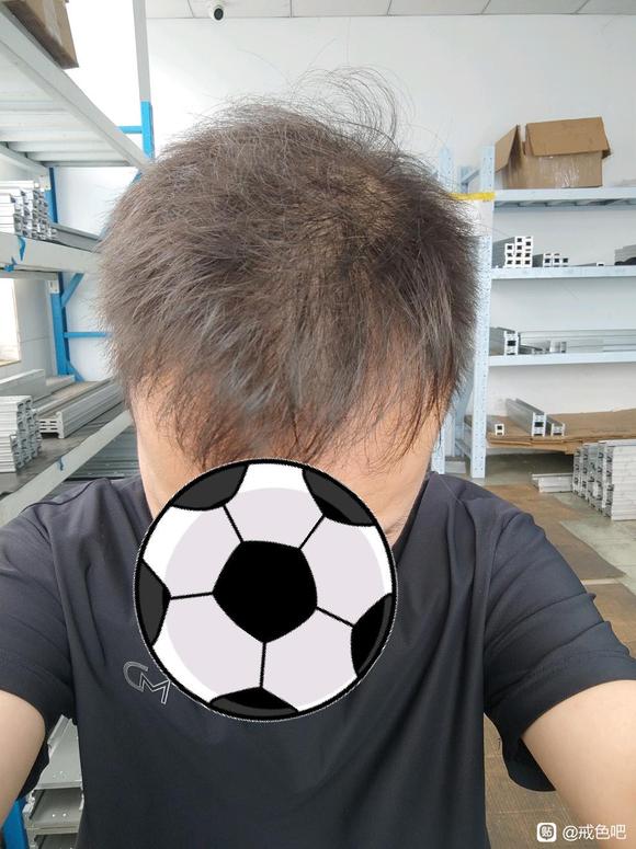 ”头发成这样了怎么办啊