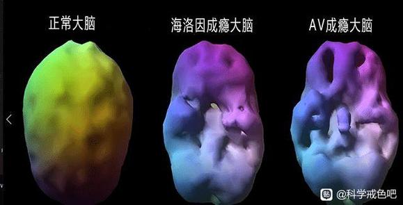 ”8u们，这个图是ct,x光，还是什么图