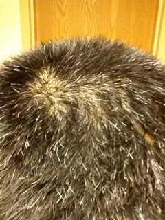 ”【问题求助】sy5年，后脑勺都是白头发，戒了能黑回来吗，能的话