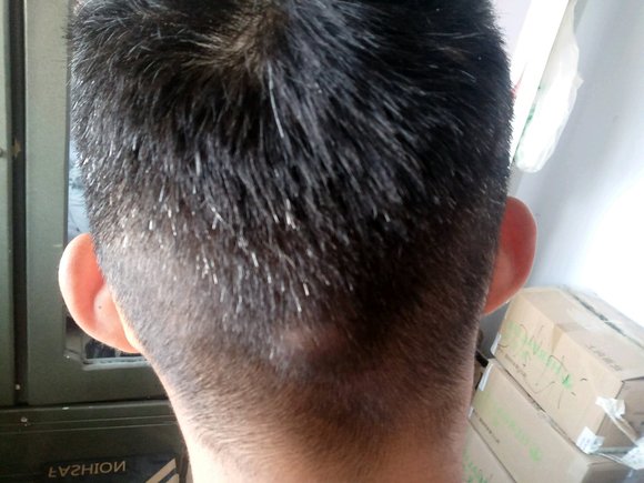 ”撸龄7年现在白发多今年21