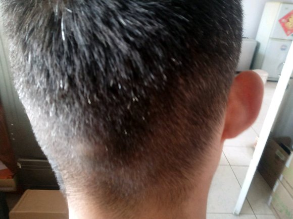 ”撸龄7年现在白发多今年21