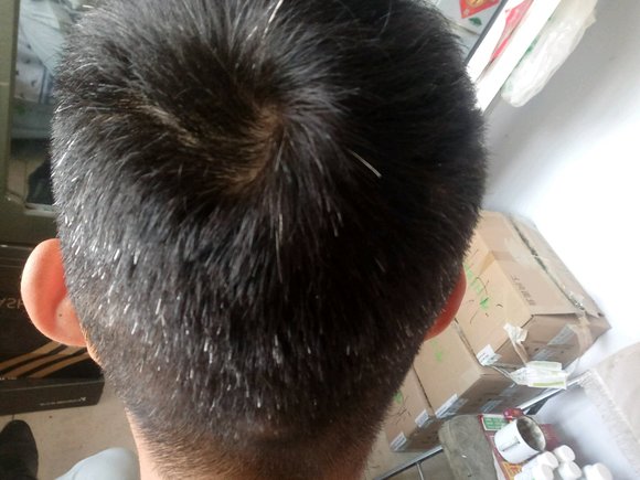 ”撸龄7年现在白发多今年21