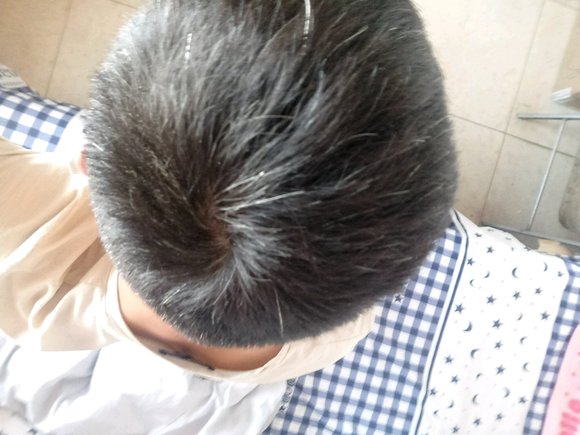 ”撸龄7年现在白发多今年21