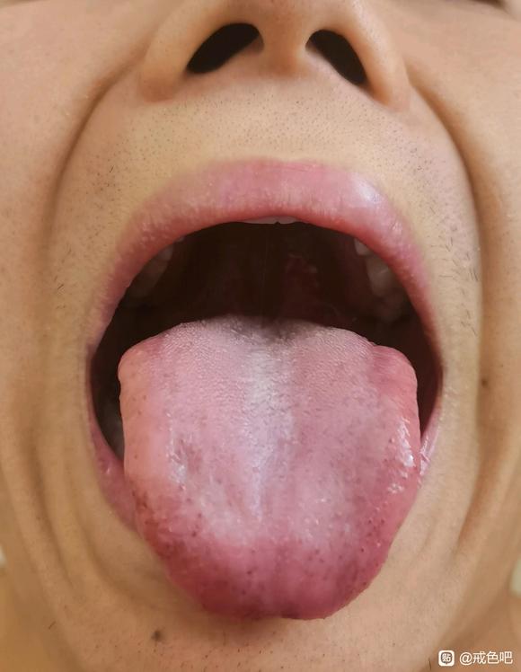 ”师兄们，我这个舌苔适合吃柴胡疏肝散吗？