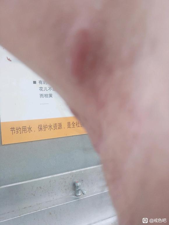 ”最近身上很痒