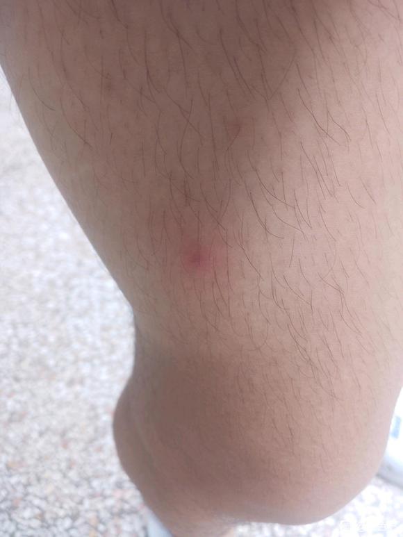 ”最近身上很痒