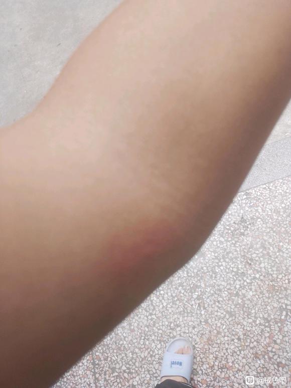 ”最近身上很痒