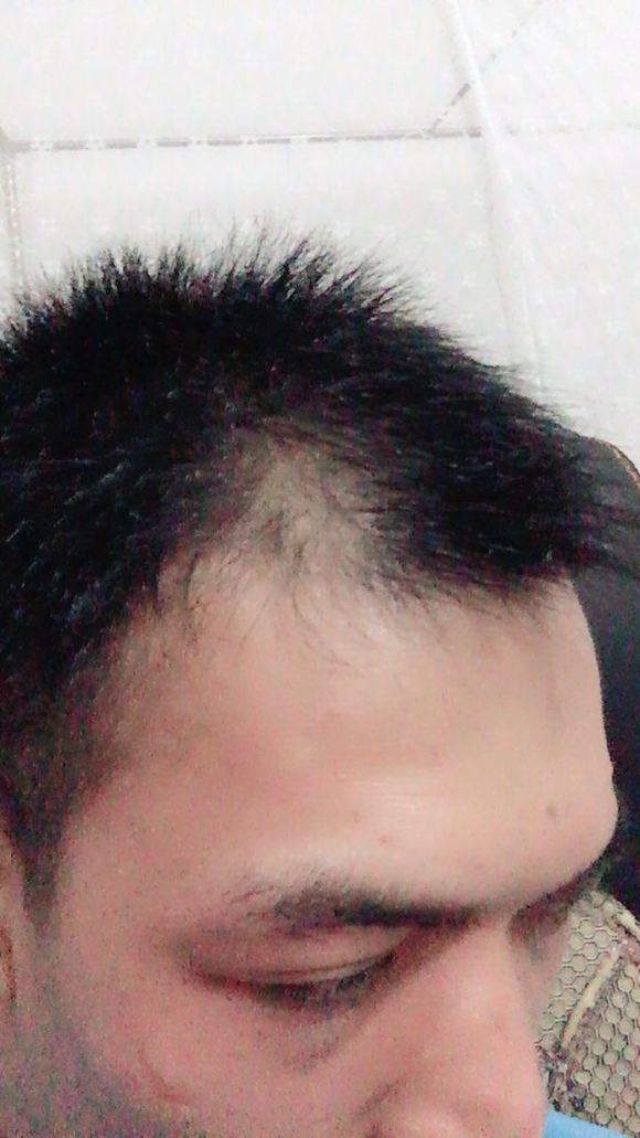 ”sy十多年了，哎。。。