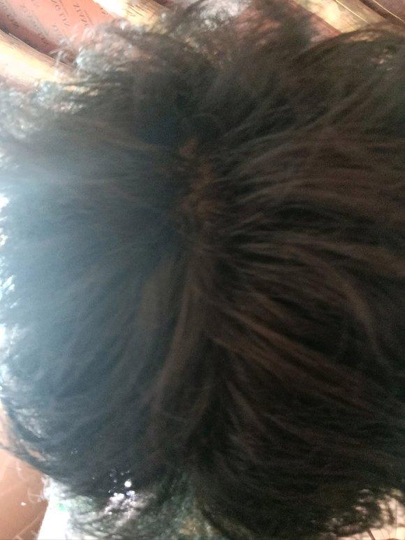 ”太秃了，赶快戒掉吧！而且我之前发质又黑又直有光泽，现在头发变