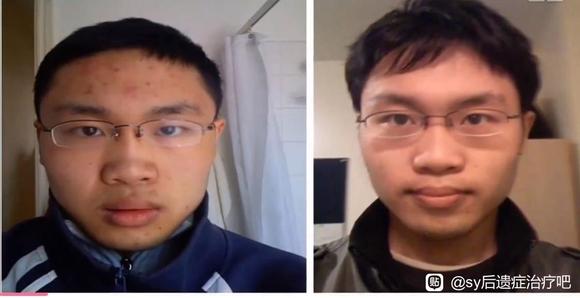 ”#微信看病卖药是假的#戒色116天对比图