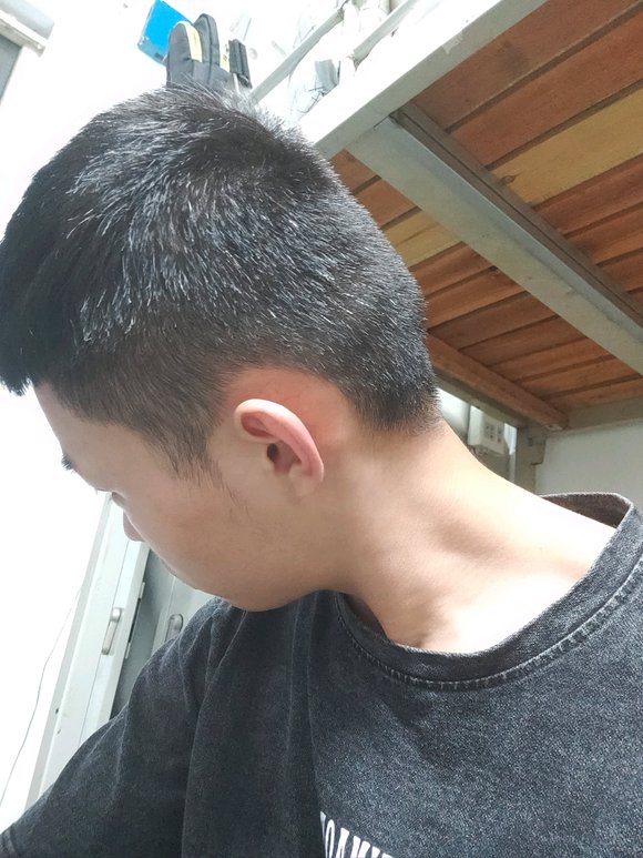 ”唉，想想现在真是后悔呀，生不如死，不知道戒掉后白头发问题能不