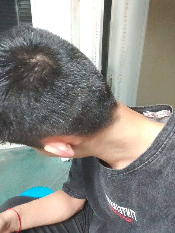 ”唉，想想现在真是后悔呀，生不如死，不知道戒掉后白头发问题能不