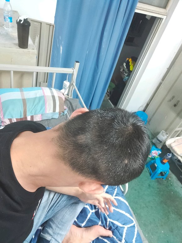 ”唉，想想现在真是后悔呀，生不如死，不知道戒掉后白头发问题能不