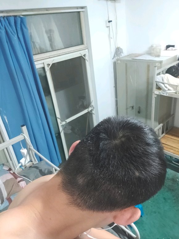 ”唉，想想现在真是后悔呀，生不如死，不知道戒掉后白头发问题能不