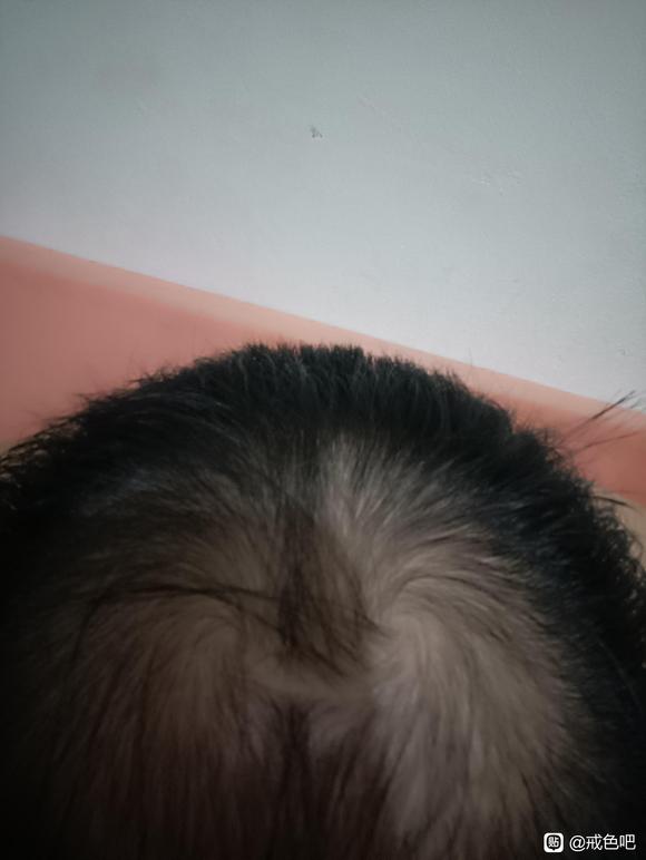 ”今天看中医他说我这伤肾造成的，让我禁欲，我这还有救吗？有人吗