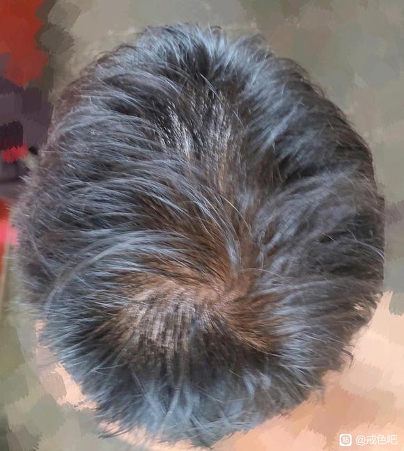 ”才20岁头发就这样了，呜呜